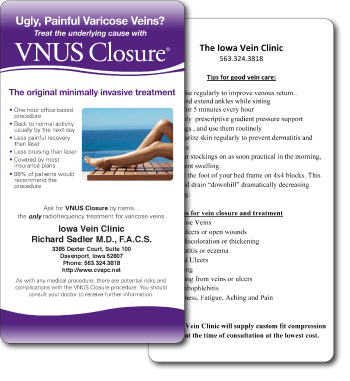 Marketing Cards for 'VNUS Closure' procedure.